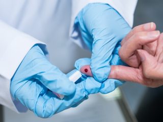 Serology